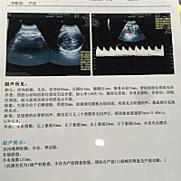 又一次通过…宝宝你那么棒，你妈妈是知道的😊