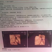 医生啥也没说，有懂的妈咪帮我解释一下吧，感谢(◍•ᴗ•◍)❤