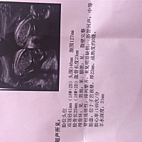 大家帮忙看看是男宝还是女宝，怀孕差2天18周。