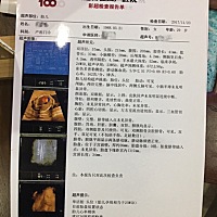 谁会看男孩女孩 4维报告能看出男女么