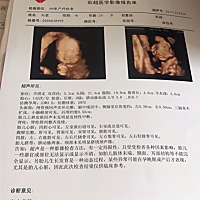 怀孕六个月了，可以看出来男孩女孩吗？