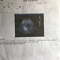 我现在已经31周了 非常非常好奇宝宝是男是女啦😊各位姐姐们能不能帮我看看啊