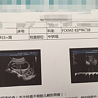 麻烦大家帮忙看一下是男孩还是女孩
