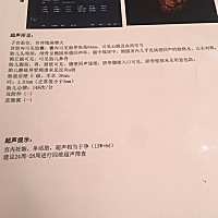 刚做的nt说一切正常