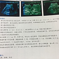 快生了，想知道男孩女孩？好奇，准备宝宝用品好选颜色，嘻嘻，有没有赐教的啊