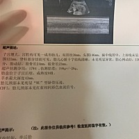 有没有19周➕4天的，晚上睡觉不舒服，想尿尿去尿的时候就一点点！