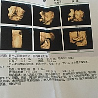 这是男孩女孩你们会看吗