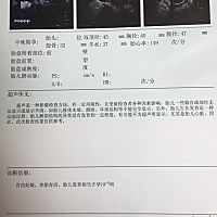 帮忙看下我家的是男宝女宝？