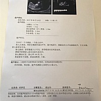 有谁这样能看出男宝还是女宝宝吗？