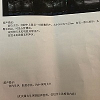 亲们，帮我看看彩超单，有没有问题啊，看到雏形就有点害怕😶😶