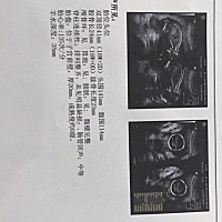 大家帮忙看看男宝女宝，都好喜欢，特别期待^_^^_^