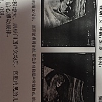 第一次看到成型的小宝宝，很震撼，不知道是男孩还是女孩，哈哈