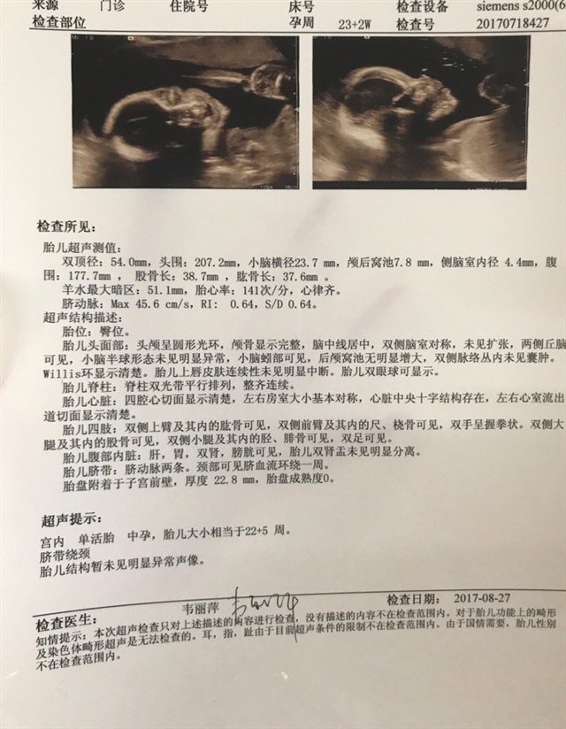 亲们，谁会看这个是女宝还是男宝，谢谢！