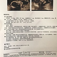 亲们，谁会看这个是女宝还是男宝，谢谢！
