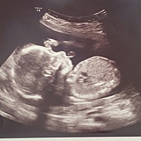 宝宝太可爱了，抓头吹泡泡吗?😂😂