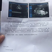 我的两个亲宝贝