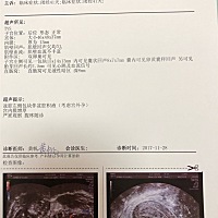 今天查出宫外孕，得知这个消息有些沮丧，但是我要坚强，加油！下午四点做手术，还要切掉我一个输卵管，...