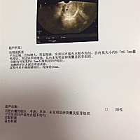 今天去医院检查，是宫内，但是还没有看见明显的卵黄囊和胎芽组织，医生让我保胎一周再看情况，好担心，...