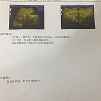 NT是什么，今天去医院只检查这个其它什么都没有。