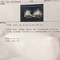 终于看见。还是有点流血。慢慢长一定会好起来的。 加油我的小小宝。