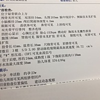 其实很想知道男宝女宝，好准备宝宝衣服之类的，四维不给说！