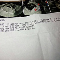 谁能看懂这个单子的