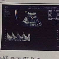 做四维了能看性别吗？很好奇男宝宝，还是女宝宝呢，求高人指导，谢谢