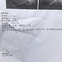 孕12 5帮忙看男女