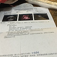 三十周了，胎儿偏小一周，怎么办