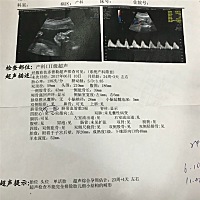 好奇是男孩还是女孩？