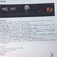 帮我看看男宝女宝