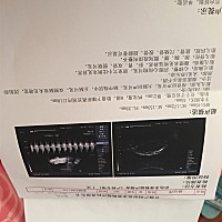 有没有孕妈知道胎盘边缘离宫颈内口18mm，要怎么样才能提高上去，医生说我胎盘太低了，我有点害怕，孕后...