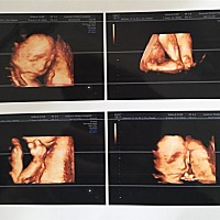 今天做四维啦，有能看懂的吗？想知道男宝女宝，好起名字~谢谢啦。