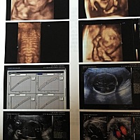 做了四维看不懂 ，麻烦帮忙看看是男孩女孩？想给宝宝起名字了