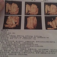 有能看出性别吗