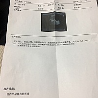 朋友们，帮忙看看，有没有事，医生说需要保胎，如果不保胎就没希望了，谁懂帮忙看看？这个我家附近的小...