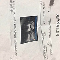 9周时的B超图，能看出男孩女孩吗？双胞胎