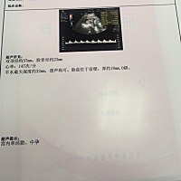 比较好奇！ 谁能看得懂这是男孩女孩哦！ 谢谢