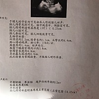 宝妈、帮忙看看男孩女孩、希望早点知道、起名字