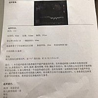 谁帮我看看是男宝女宝