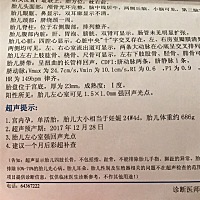 谁能看出来这是男宝还是女宝的？