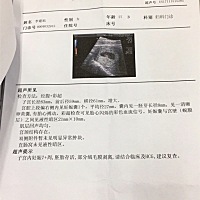 帮忙看下男孩，女孩？