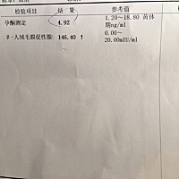 请教各位 月经10.29最后一次 现在肚子疼 没见红 是不是宫外孕