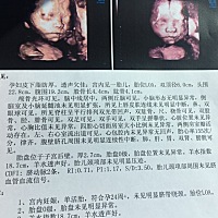 已得知肚子里的是男宝，十二年前生了女宝，十二年后又得男宝，凑成“好”字了，期待宝宝的到来😘