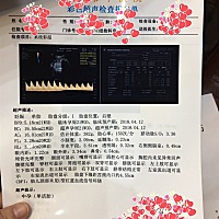 30号刚做的系统b超，能看出是男宝还是女宝吗？有点感兴趣😋欢迎👏宝妈们踊跃留言✌️