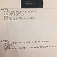 这是12周检查的nt.帮我看看女孩 男孩🙏谢谢