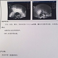 做了阴超，没有胎心。还有没有可能长出来啊😢