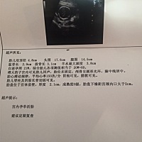 帮忙看看男孩女孩