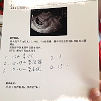 帮我看下是男宝还是女宝，欢迎宝妈踊跃留言👏感谢各位宝妈们，愿我们怀孕期间顺顺利利健健康康！