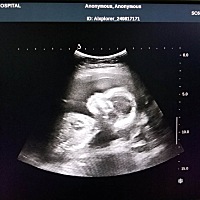 二宝是个男娃娃，这回组成了一个好字，完美了